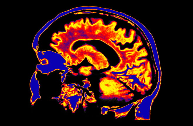 Decorative image of a brain scan.