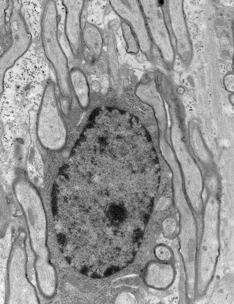Transmission electron microscope image of an oligodendrocyte nucleus and cell body surrounded by myelinated axons.